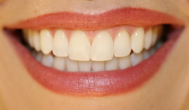 Причина улыбаться почаще: натуральное средство из куркумы для качественного отбеливания зубов!